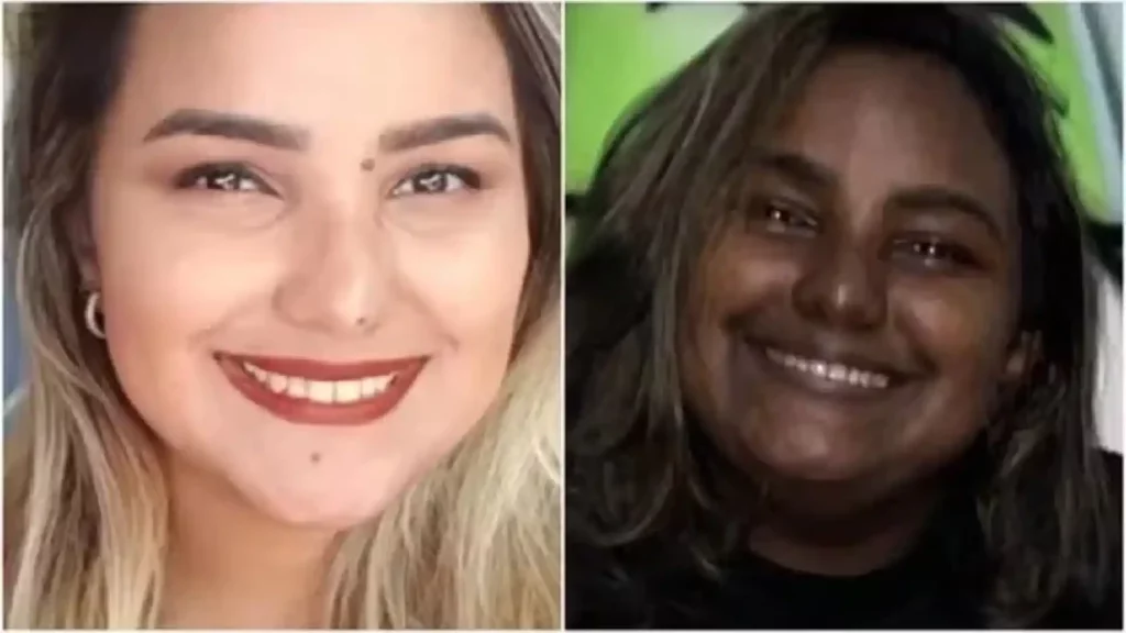 Cearense doen&ccedil;a que mudou cor da pele. foto: Reprodu&ccedil;&atilde;o